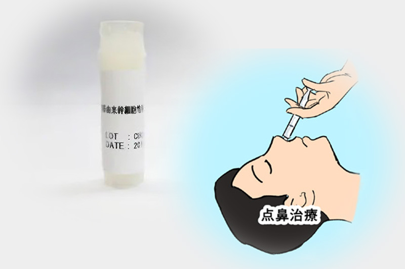幹細胞培養上清液と点鼻治療のイメージ