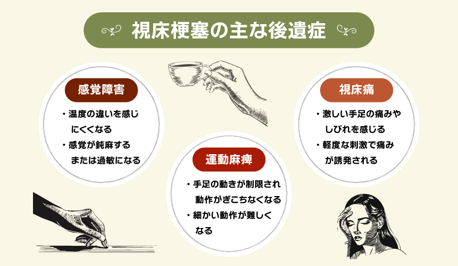 視床梗塞の主な後遺症