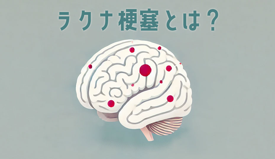 多発性脳梗塞とは