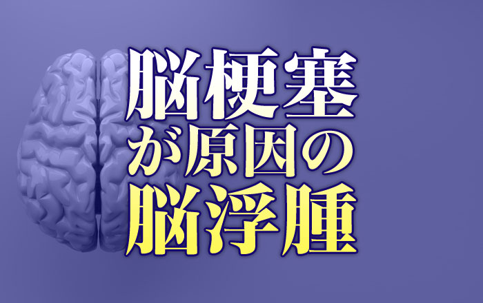 脳浮腫の原因は何ですか?