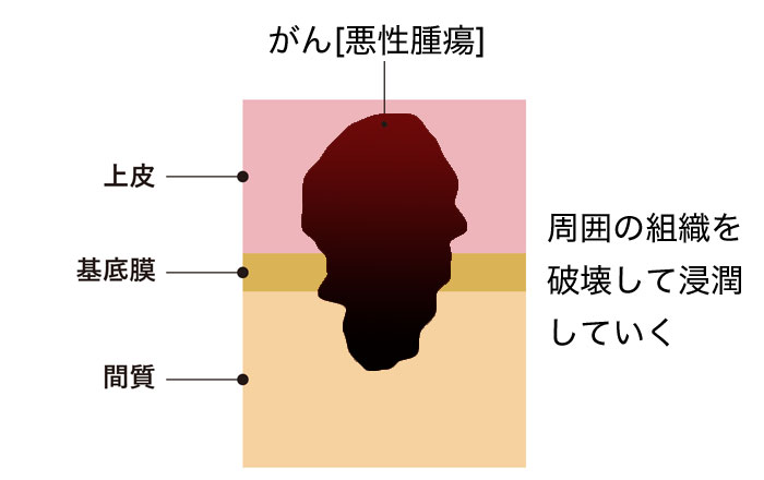 脳腫瘍に関するよくある質問