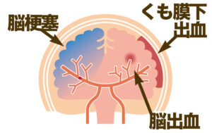 医師に尋ねるべき質問