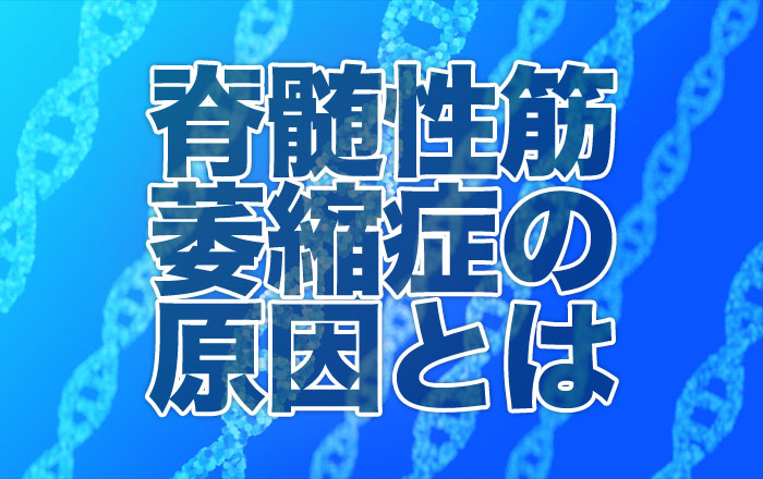 脊髄性筋萎縮症の原因とは