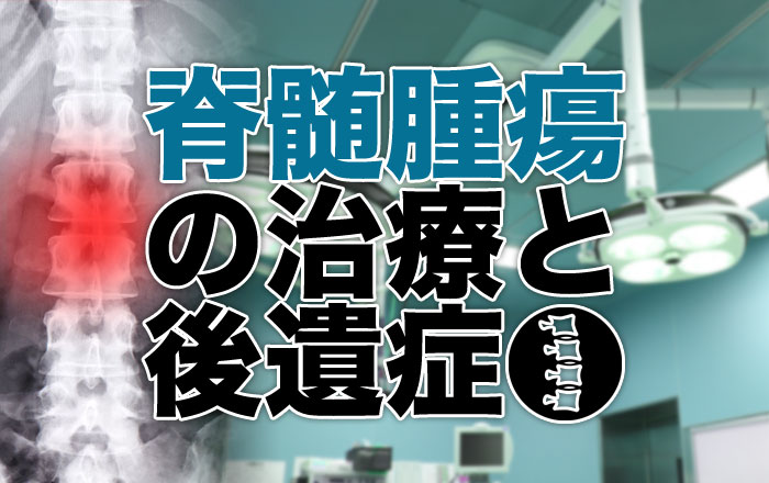 脊髄腫瘍の治療と後遺症