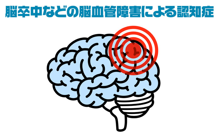 類似点と相違点