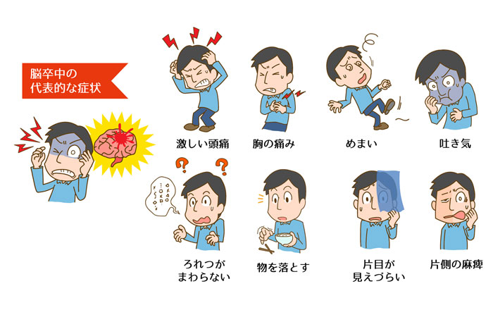 将来の脳卒中を防ぐために男性は何ができるでしょうか?