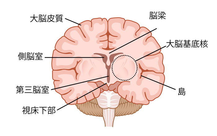 ジスキネジアとは何ですか?