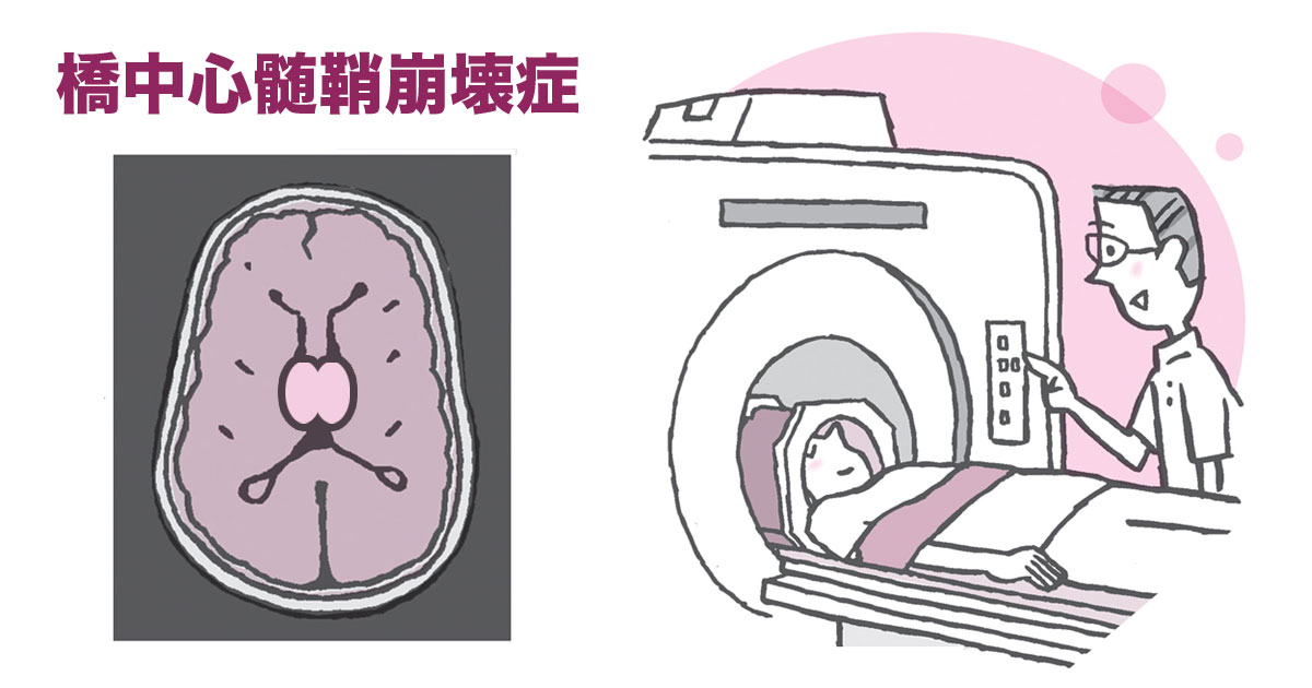 この状態の見通し