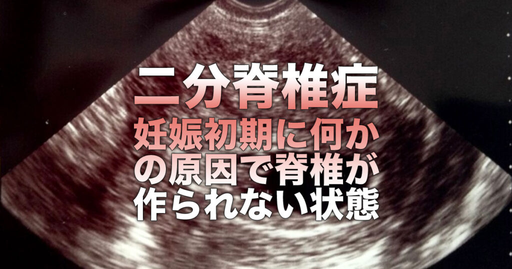 隠れ二分脊椎の症状