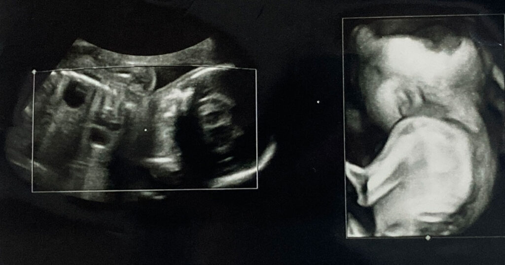 原因は何ですか?