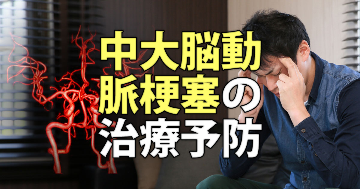 中大脳動脈梗塞の治療と予防