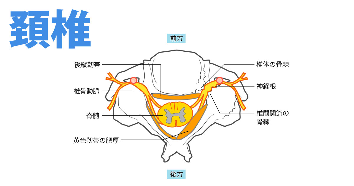 腰椎神経根症の治療