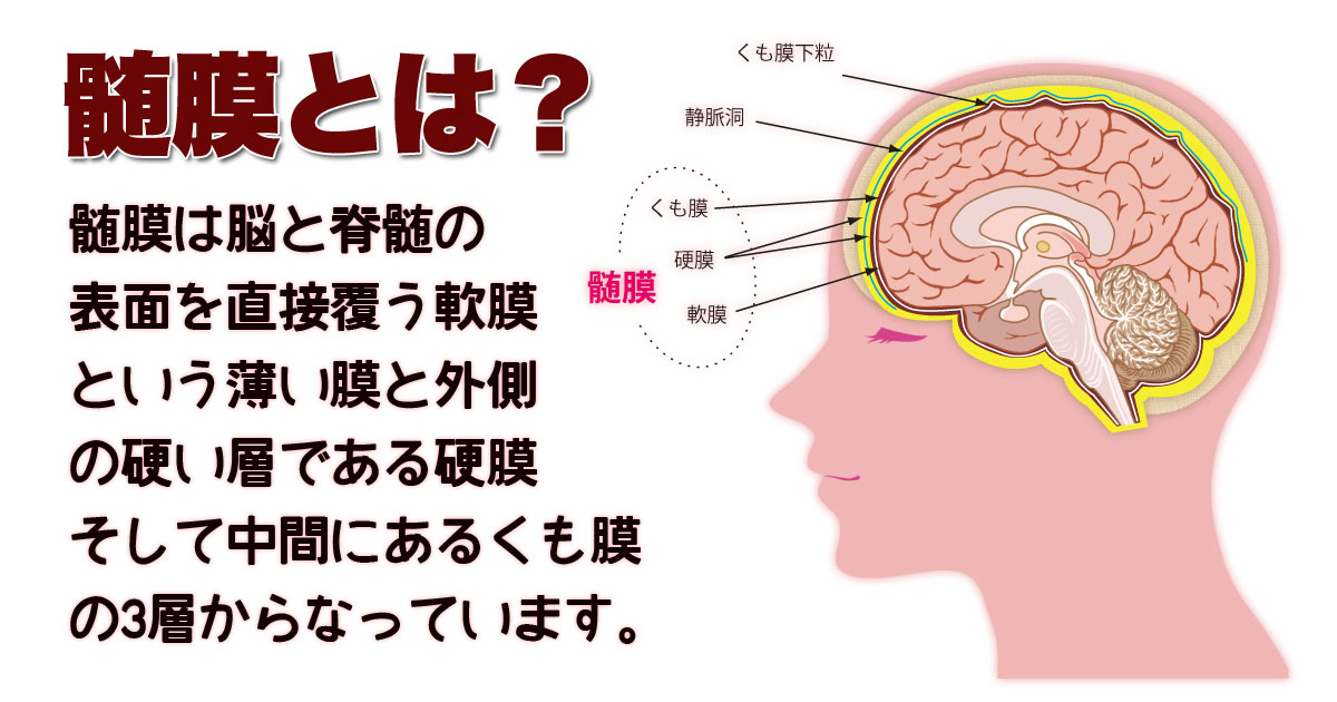  B型髄膜炎とは何ですか?