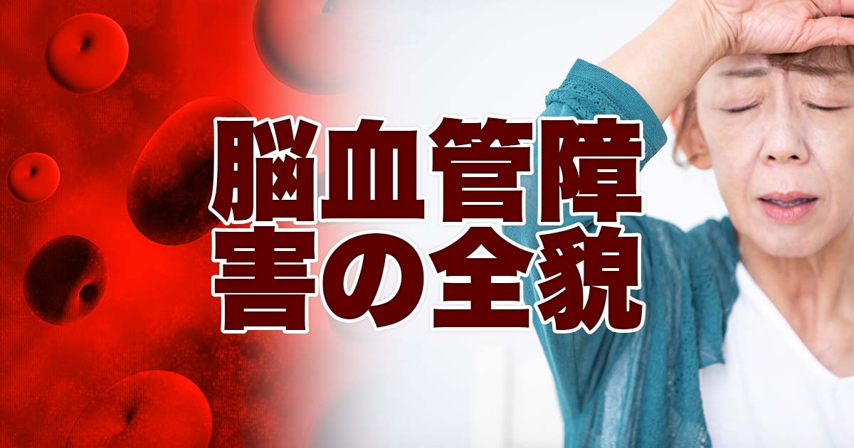 脳血管障害の全貌