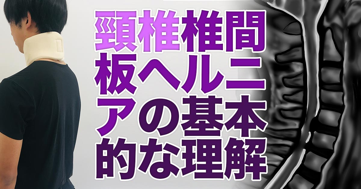 頸椎椎間板ヘルニアの基本的な理解