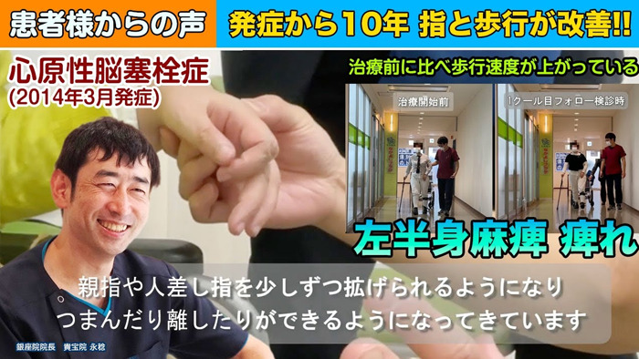 【幹細胞点滴6回投与(2クール)】発症して10年…指の動きと歩行に改善あり！