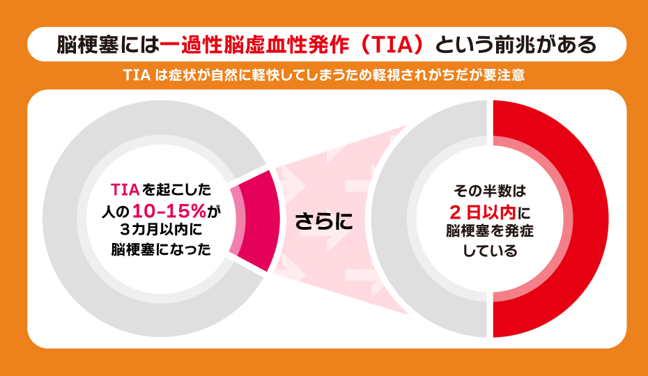 脳梗塞にはTIAという前兆がある