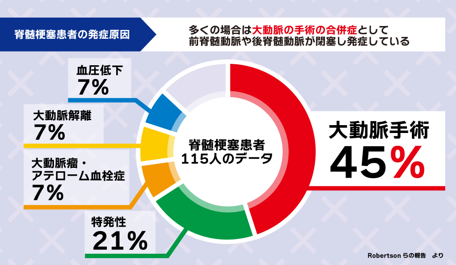 脊髄梗塞の一般的な原因