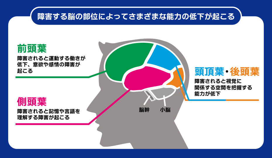 脳の4つの部位と障害