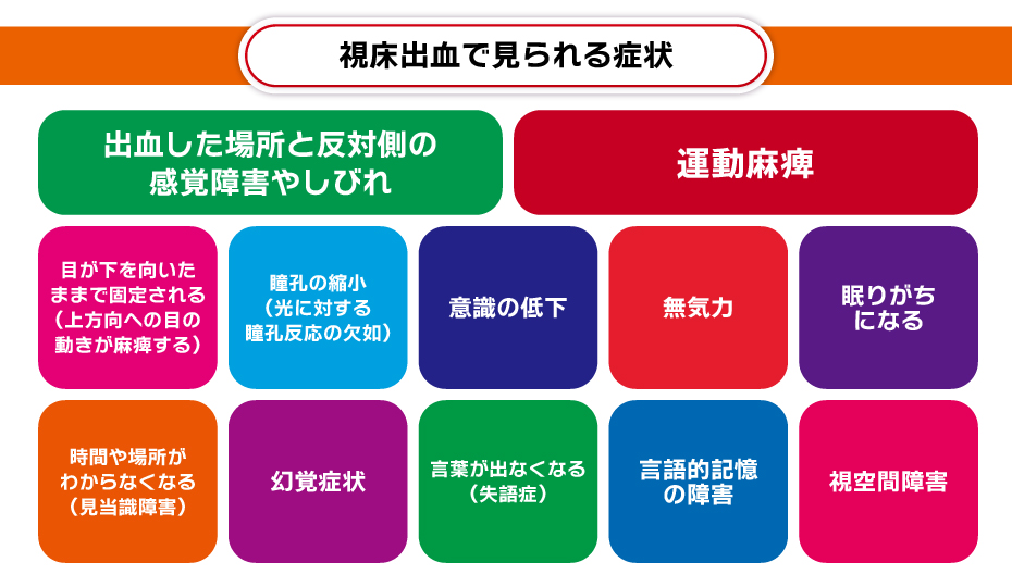 視床出血にみられる症状