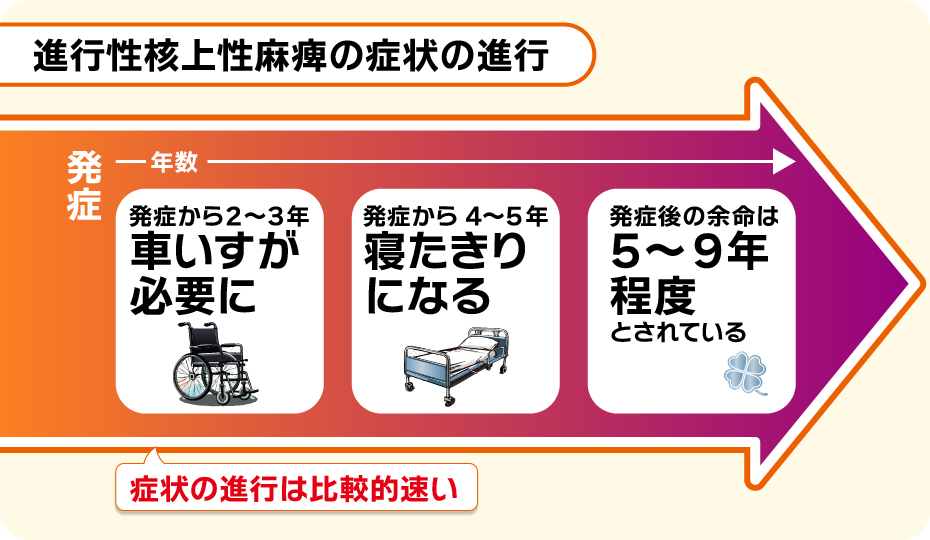 進行性核上性麻痺の症状の進行