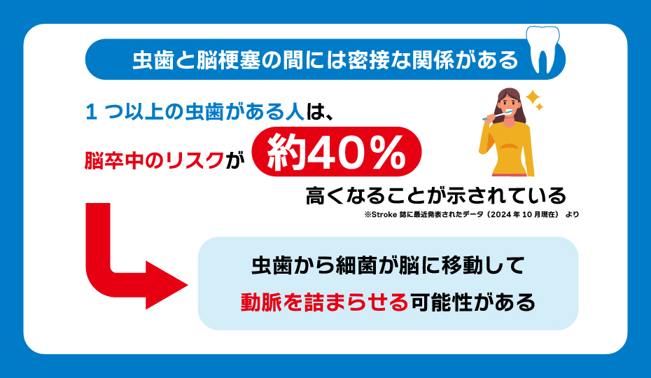 虫歯と脳梗塞の間には密接な関係がある