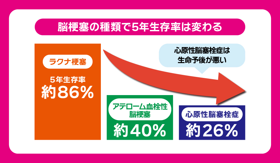 脳梗塞の種類で5年生存率は変わる