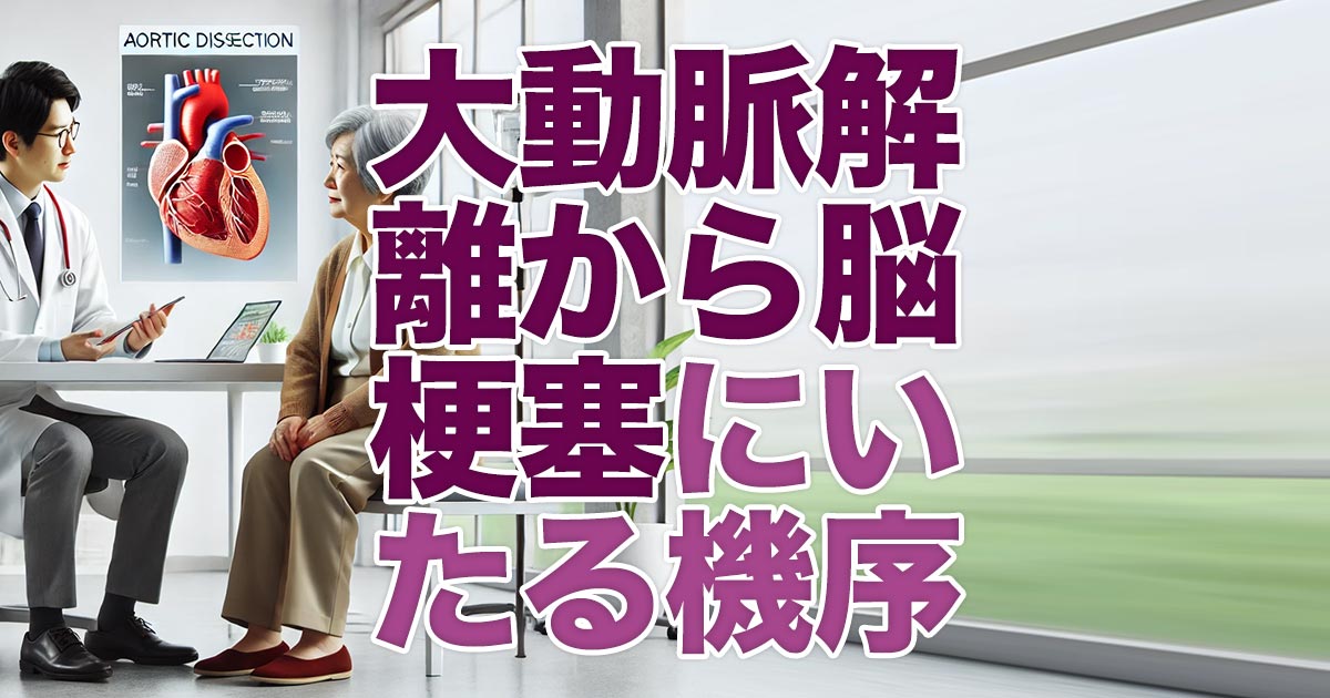 大動脈解離から脳梗塞に至るメカニズムを徹底解説