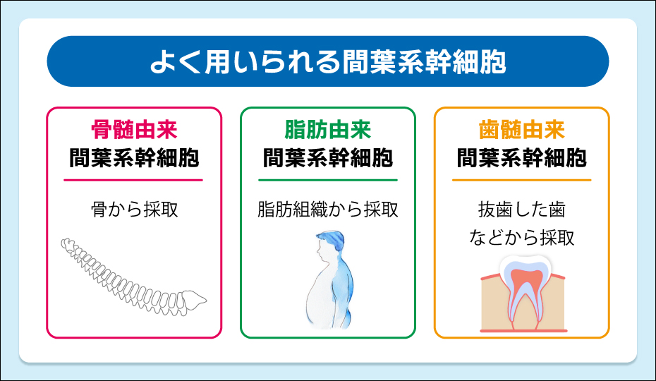 よく用いられる間葉系幹細胞