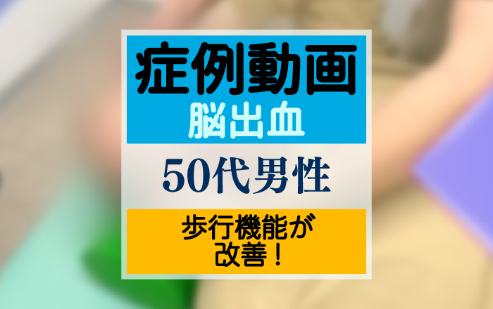 【症例紹介】歩行機能が改善！4回目の脳出血の後に左半身麻痺が出現した患者様の治療前後の比較【再生医療×同時刺激】