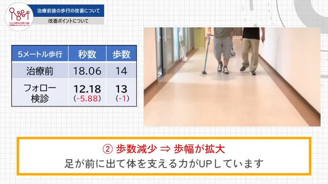 治療前後の歩行の改善について