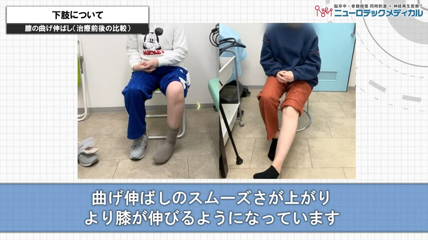 下肢について