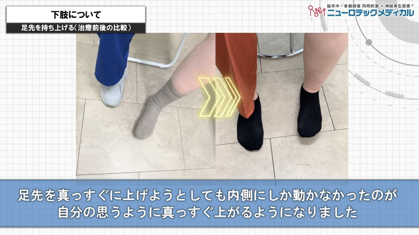 下肢について