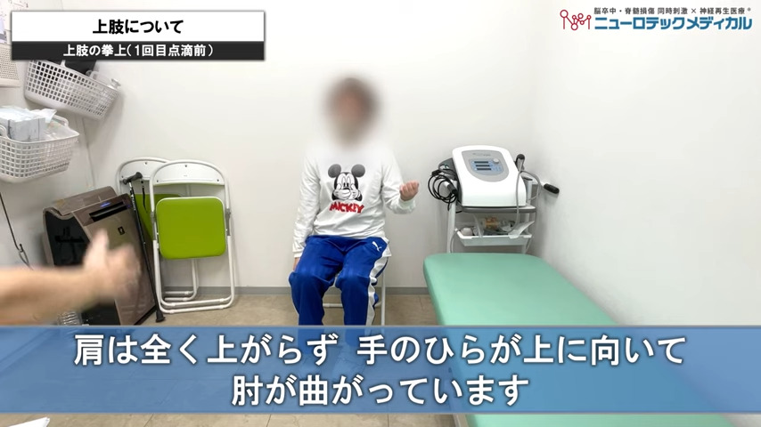 上肢について