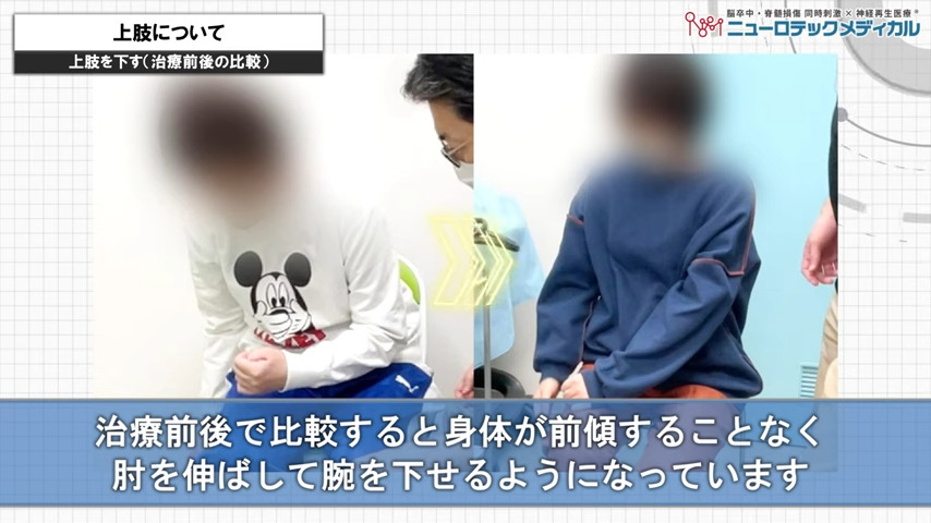 上肢について