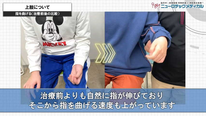 上肢について