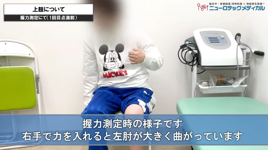上肢について