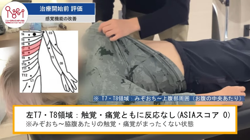 治療開始前　評価