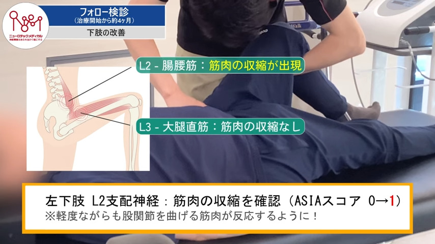 フォロー検診