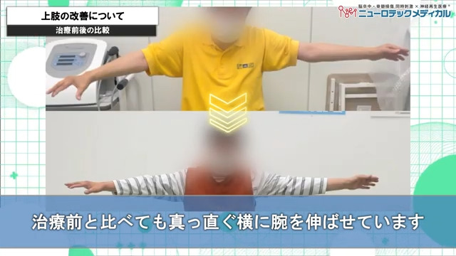 上肢の改善について