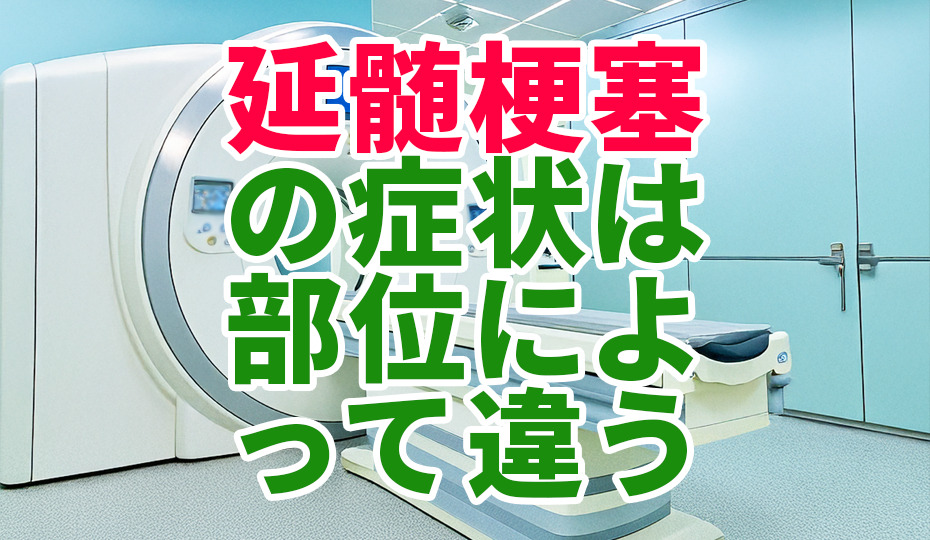 延髄梗塞とは？内側・外側で異なる症状の違いを理解する