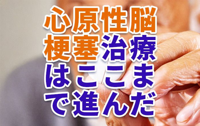 脳梗塞の治療はここまで進んだ。重症化しやすい「心原性」の未来を変えた医療