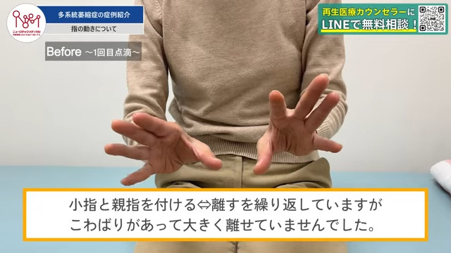 指がこわばっている様子