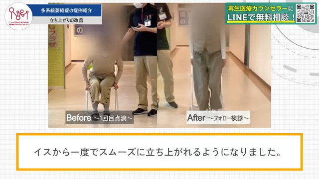 治療前と治療後の立ち上がり方の比較