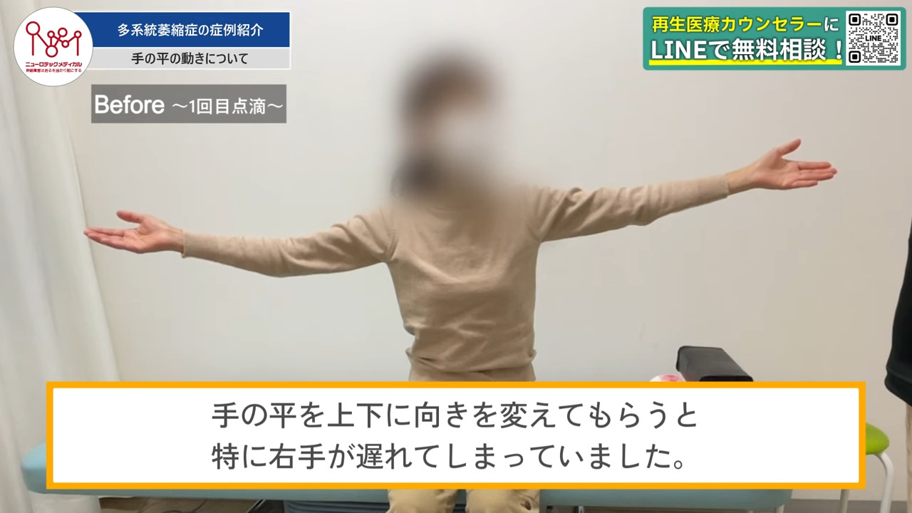 手の平の向きを変える様子