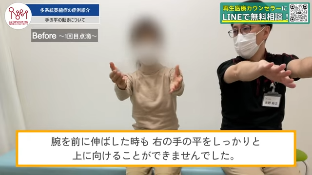 腕を前に伸ばして手の平の向きを変える様子
