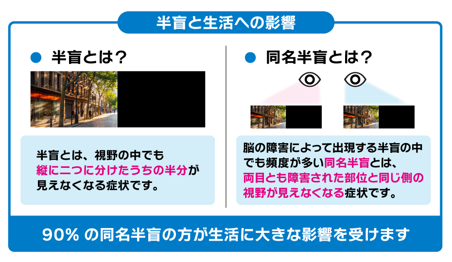 半盲と同名半盲の症状と生活への影響についての体系図