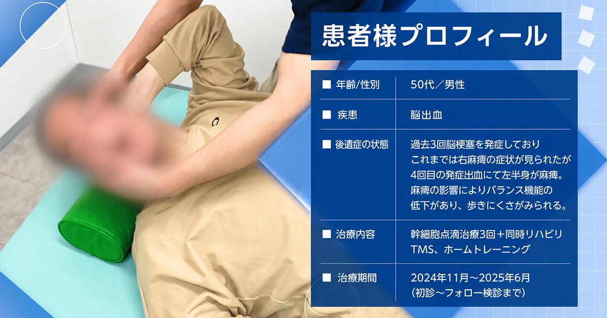 4回目の脳出血後に左半身麻痺と歩行バランス機能の低下がみられた50代男性の症例です。